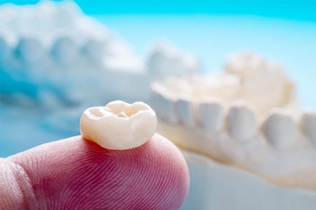 a closeup of a dental crown on a finger