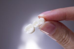 Person holding their fallen dental bridge